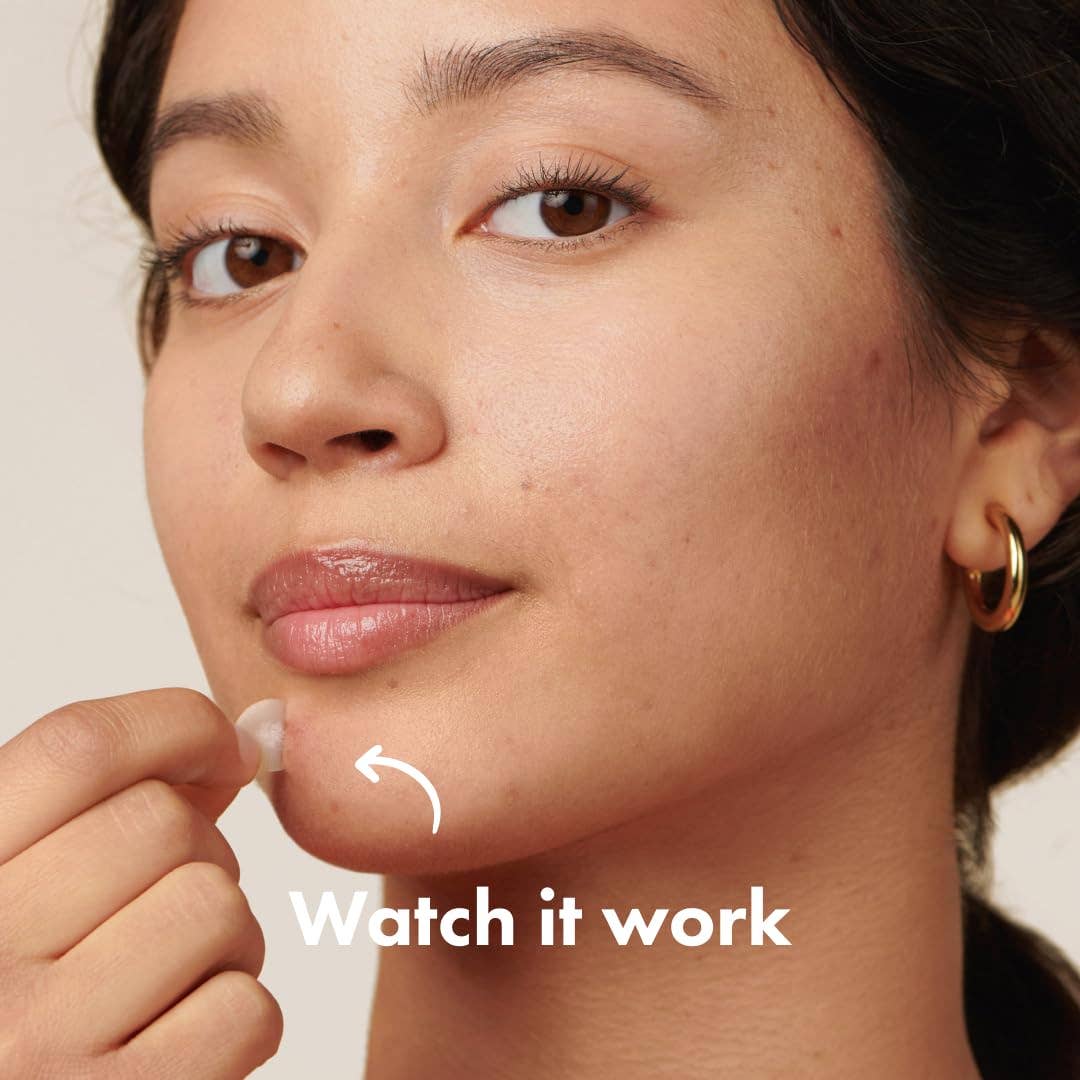 Mighty Patch Original – Spot Patches