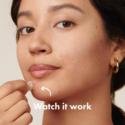 Mighty Patch Original – Spot Patches