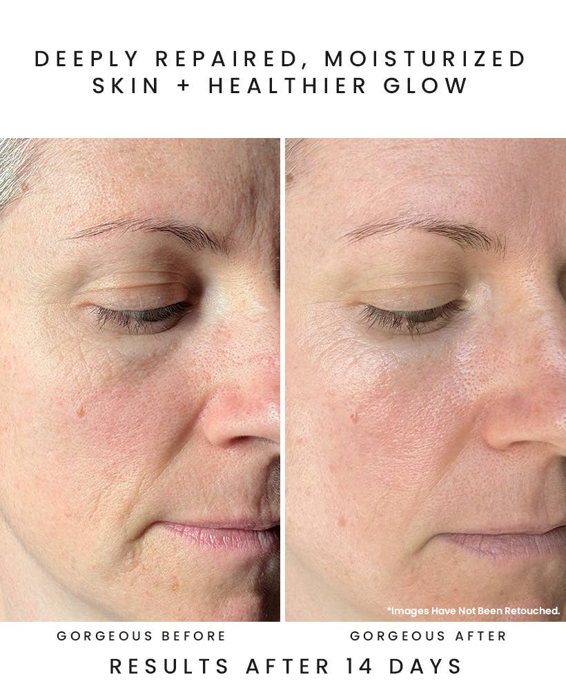 NYMPH NECTAR Superfruit Repair Balm: Sea Vitamin C