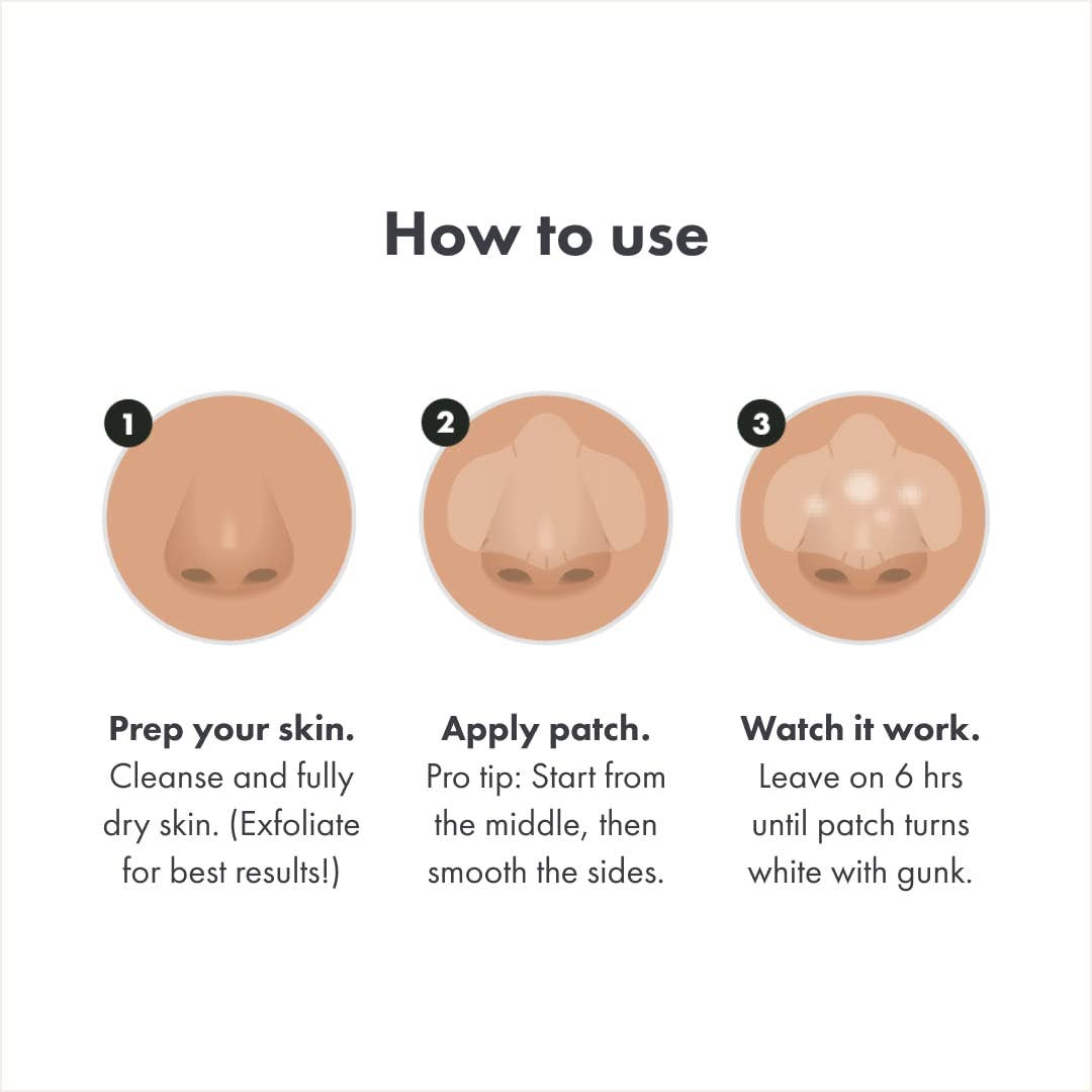 Nose Gunk Patch – 10 Ct